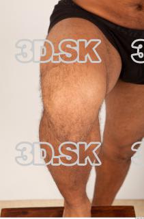 Knee texture of Ron 0002